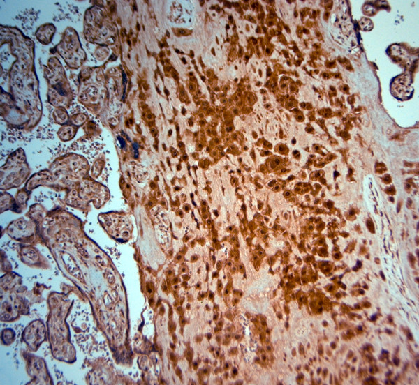 SRD5A2 Antibody in Immunohistochemistry (Paraffin) (IHC (P))