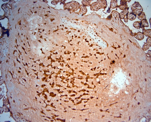 SRD5A2 Antibody in Immunohistochemistry (Paraffin) (IHC (P))