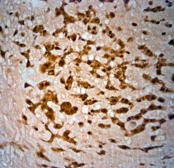 SRD5A2 Antibody in Immunohistochemistry (Paraffin) (IHC (P))