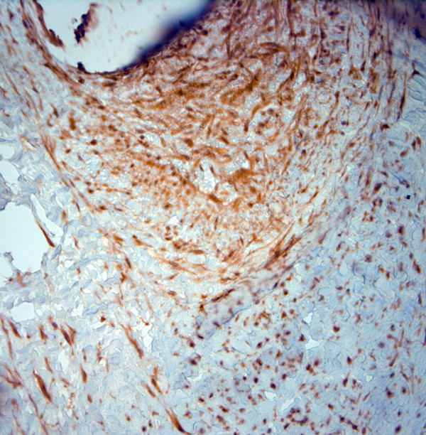 SRD5A2 Antibody in Immunohistochemistry (Paraffin) (IHC (P))