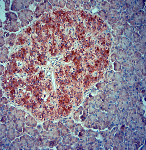 SRD5A2 Antibody in Immunohistochemistry (Paraffin) (IHC (P))