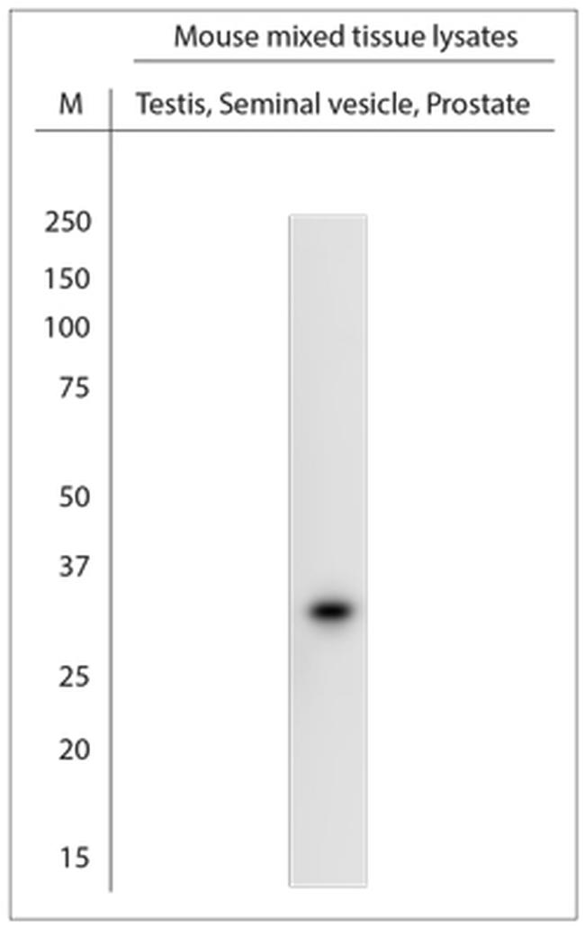 SRD5A2 Antibody in Western Blot (WB)