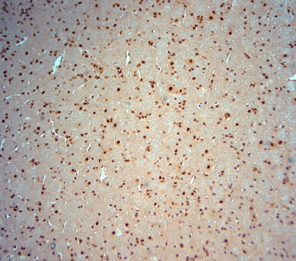 Striatin 4 Antibody in Immunohistochemistry (Paraffin) (IHC (P))