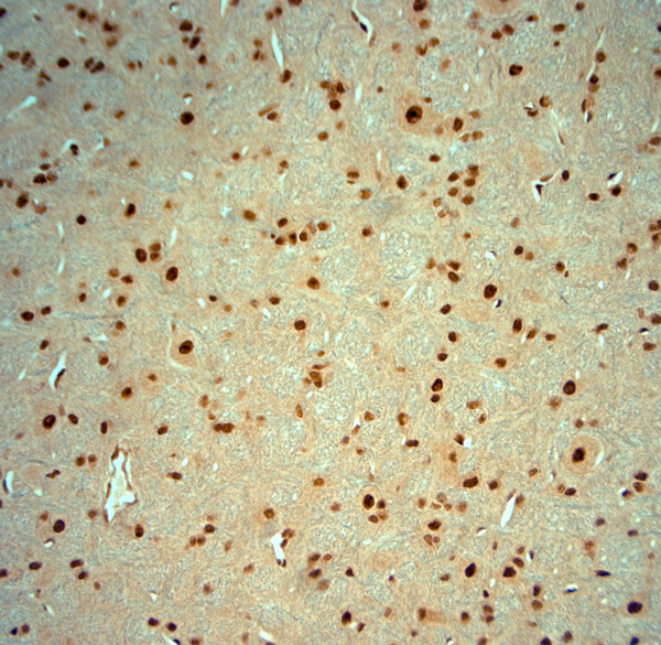 Striatin 4 Antibody in Immunohistochemistry (Paraffin) (IHC (P))