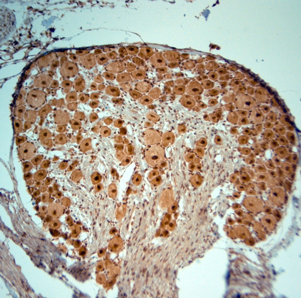 Striatin 4 Antibody in Immunohistochemistry (Paraffin) (IHC (P))