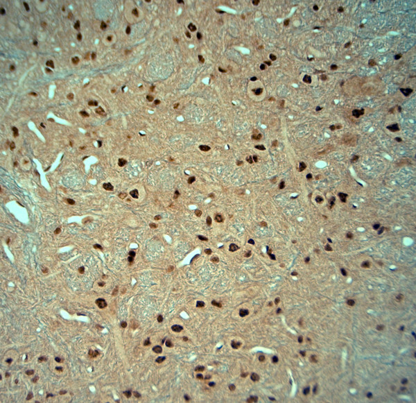 Striatin 4 Antibody in Immunohistochemistry (Paraffin) (IHC (P))