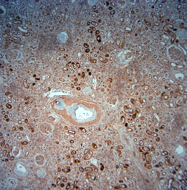 SLC5A8 Antibody in Immunohistochemistry (Paraffin) (IHC (P))