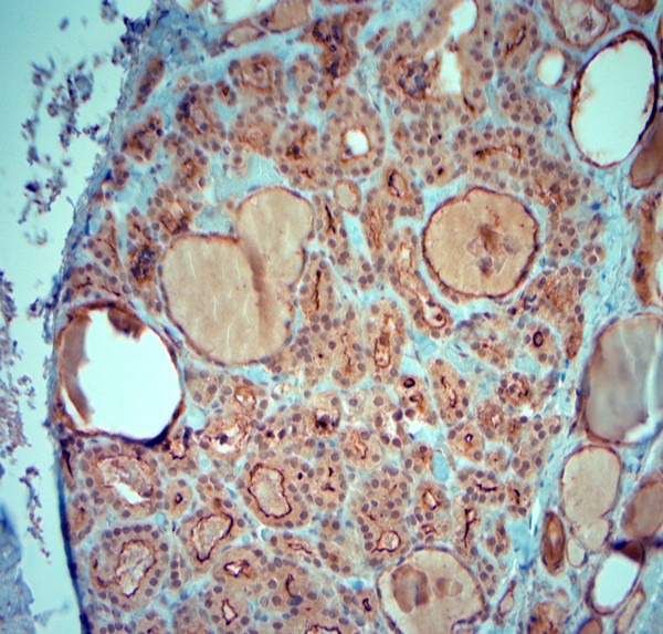 SLC5A8 Antibody in Immunohistochemistry (Paraffin) (IHC (P))