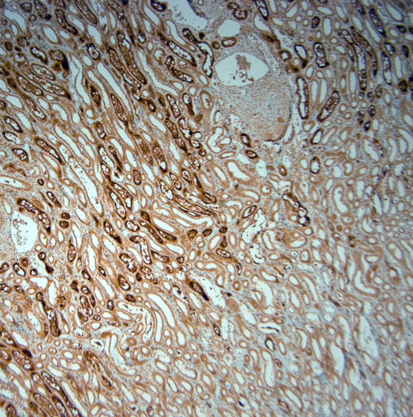 SLC5A8 Antibody in Immunohistochemistry (Paraffin) (IHC (P))