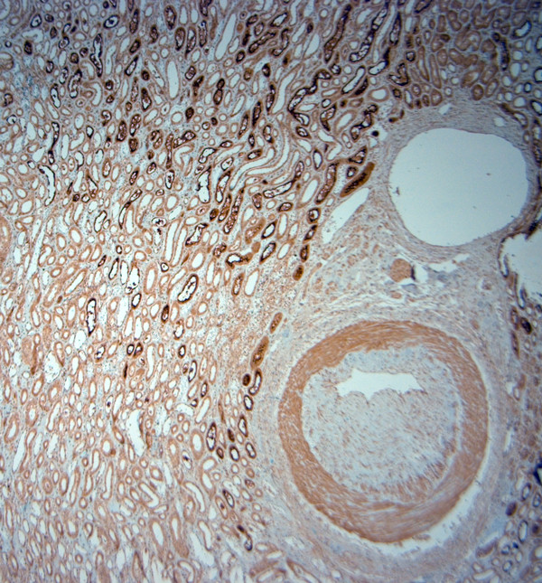 SLC5A8 Antibody in Immunohistochemistry (Paraffin) (IHC (P))