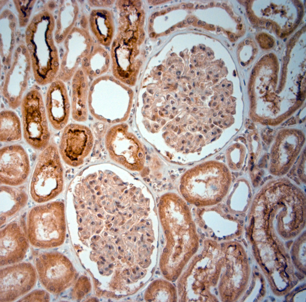 SLC5A8 Antibody in Immunohistochemistry (Paraffin) (IHC (P))