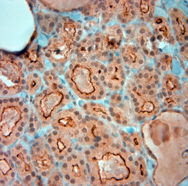 SLC5A8 Antibody in Immunohistochemistry (Paraffin) (IHC (P))