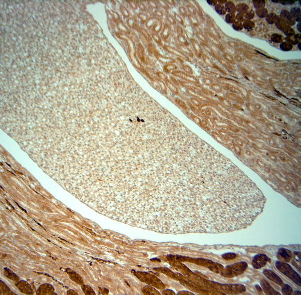 SLC30A5 Antibody in Immunohistochemistry (Paraffin) (IHC (P))