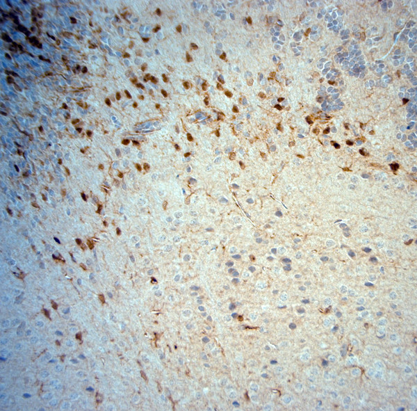 SLC30A5 Antibody in Immunohistochemistry (Paraffin) (IHC (P))