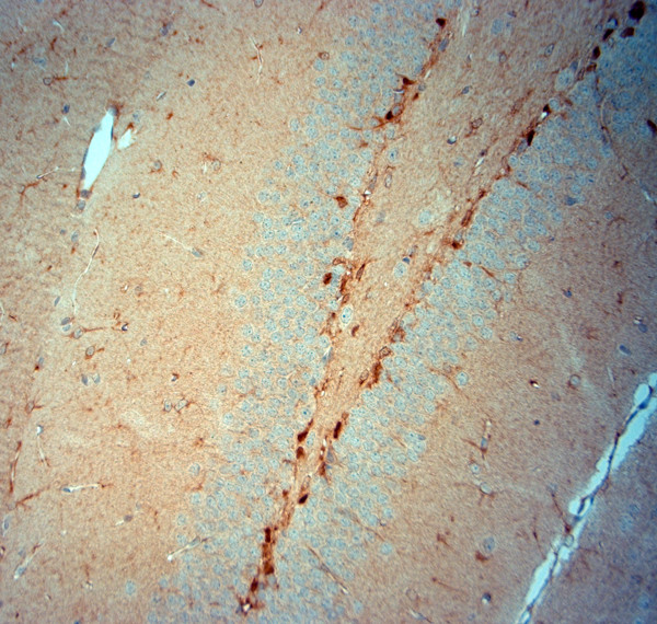 SLC30A5 Antibody in Immunohistochemistry (Paraffin) (IHC (P))