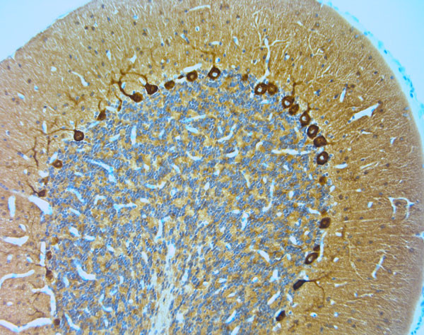 STXB1 Antibody in Immunohistochemistry (Paraffin) (IHC (P))