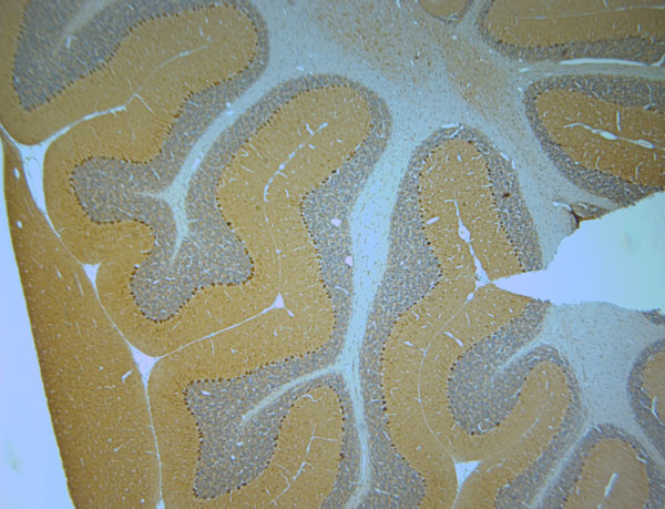 STXB1 Antibody in Immunohistochemistry (Paraffin) (IHC (P))