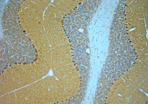 STXB1 Antibody in Immunohistochemistry (Paraffin) (IHC (P))