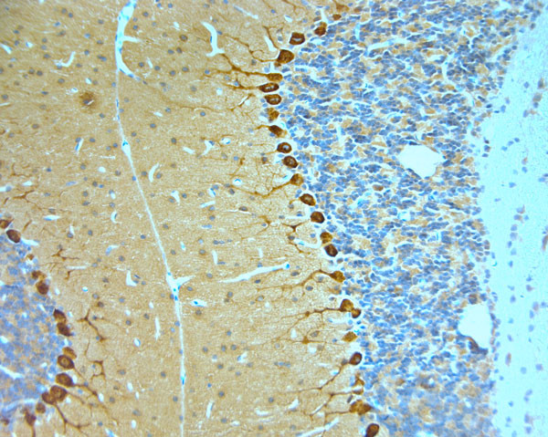 STXB1 Antibody in Immunohistochemistry (Paraffin) (IHC (P))