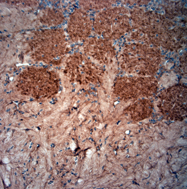 Spinophilin Antibody in Immunohistochemistry (Paraffin) (IHC (P))