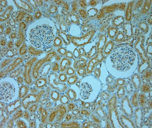 SLC6A8 Antibody in Immunohistochemistry (Paraffin) (IHC (P))