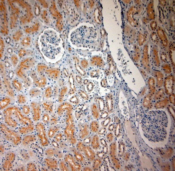 SLC17A3 Antibody in Immunohistochemistry (Paraffin) (IHC (P))