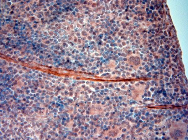 5HT4 R Antibody in Immunohistochemistry (Paraffin) (IHC (P))