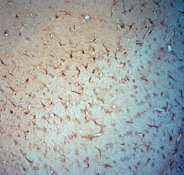 Synaptojanin1 Antibody in Immunohistochemistry (Paraffin) (IHC (P))