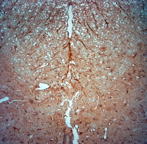 Synaptojanin1 Antibody in Immunohistochemistry (Paraffin) (IHC (P))