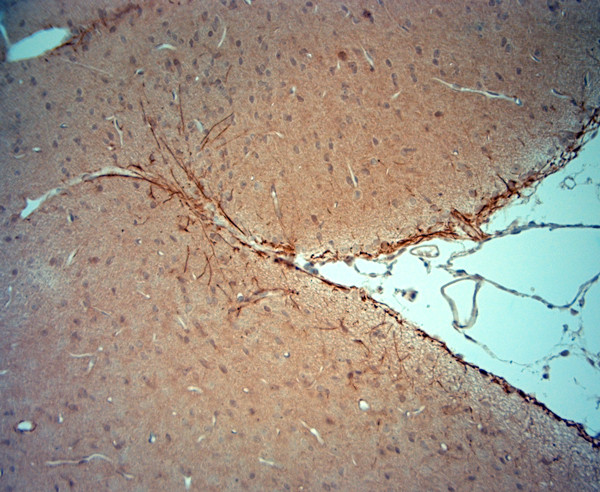 Synaptojanin1 Antibody in Immunohistochemistry (Paraffin) (IHC (P))