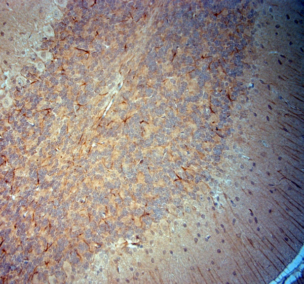 Synaptojanin1 Antibody in Immunohistochemistry (Paraffin) (IHC (P))