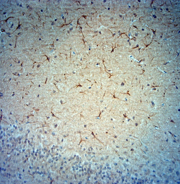 Synaptojanin1 Antibody in Immunohistochemistry (Paraffin) (IHC (P))