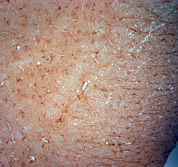 Synaptojanin1 Antibody in Immunohistochemistry (Paraffin) (IHC (P))