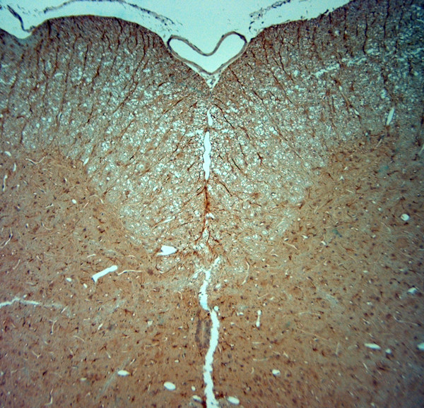 Synaptojanin1 Antibody in Immunohistochemistry (Paraffin) (IHC (P))