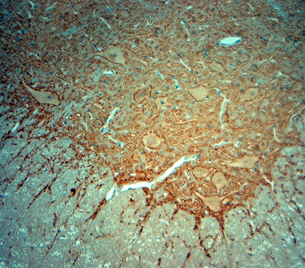 Synaptophysin Antibody in Immunohistochemistry (Paraffin) (IHC (P))