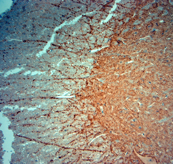 Synaptophysin Antibody in Immunohistochemistry (Paraffin) (IHC (P))