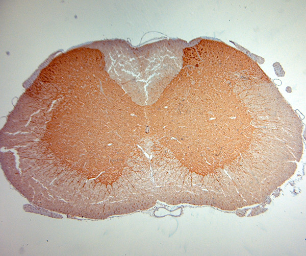 Synaptophysin Antibody in Immunohistochemistry (Paraffin) (IHC (P))