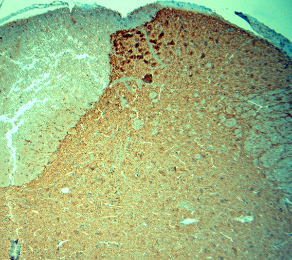 Synaptophysin Antibody in Immunohistochemistry (Paraffin) (IHC (P))