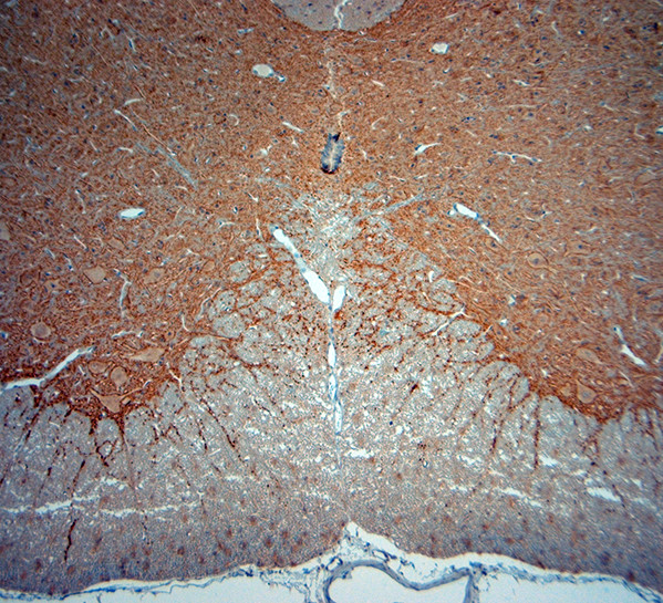 Synaptophysin Antibody in Immunohistochemistry (Paraffin) (IHC (P))