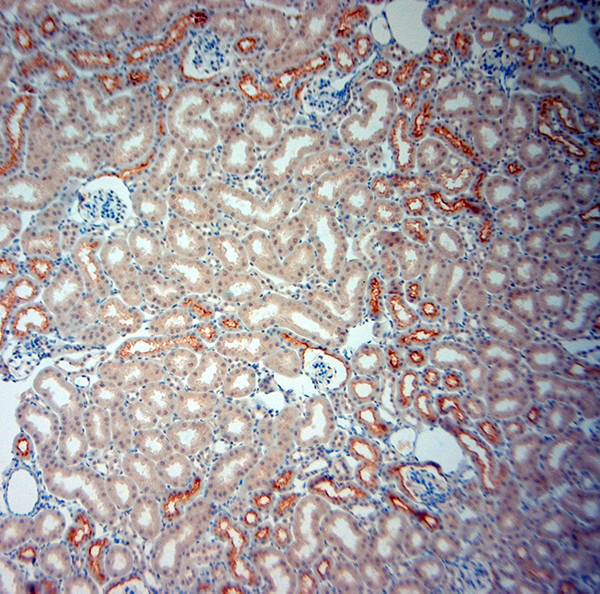 SLC6A19 Antibody in Immunohistochemistry (Paraffin) (IHC (P))