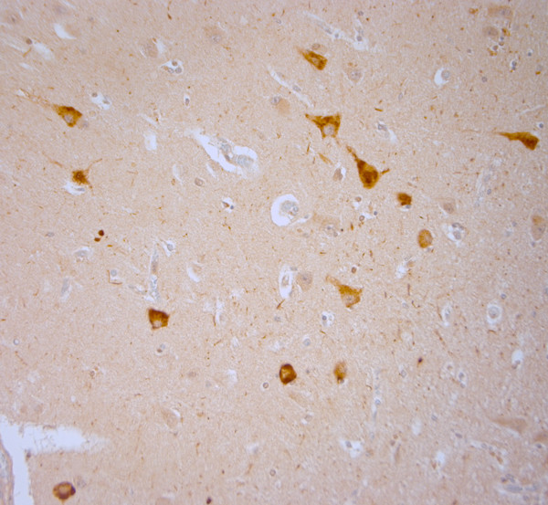 TRPV1 Antibody in Immunohistochemistry (Paraffin) (IHC (P))