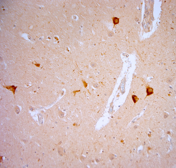 TRPV1 Antibody in Immunohistochemistry (Paraffin) (IHC (P))