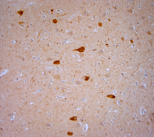 TRPV1 Antibody in Immunohistochemistry (Paraffin) (IHC (P))