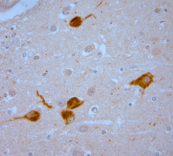 TRPV1 Antibody in Immunohistochemistry (Paraffin) (IHC (P))