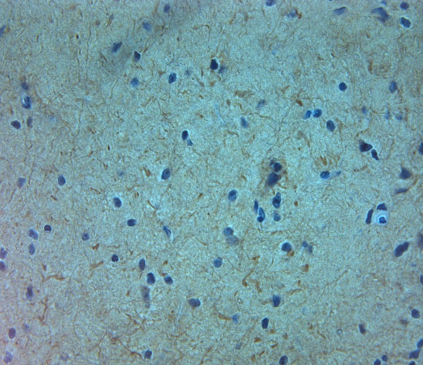 TRPM7 Antibody in Immunohistochemistry (Paraffin) (IHC (P))