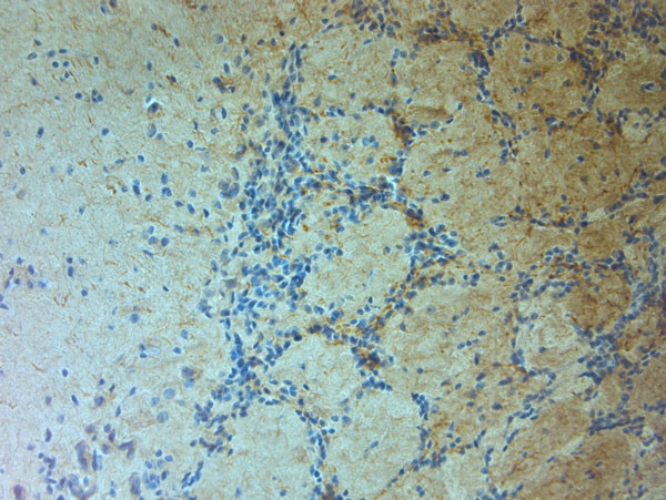 TRPM7 Antibody in Immunohistochemistry (Paraffin) (IHC (P))