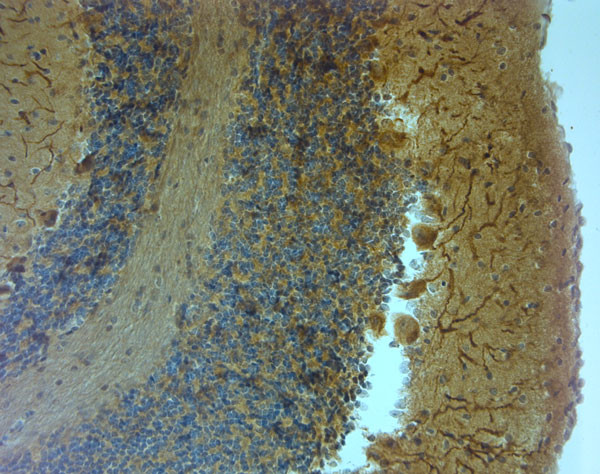 TRPM7 Antibody in Immunohistochemistry (Paraffin) (IHC (P))