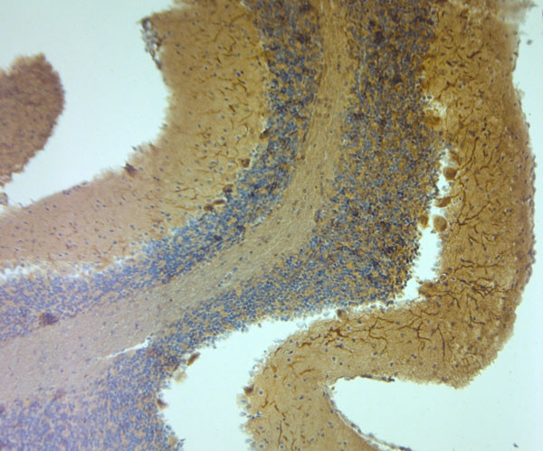 TRPM7 Antibody in Immunohistochemistry (Paraffin) (IHC (P))