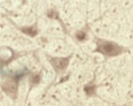 TPPC1 Antibody in Immunohistochemistry (IHC)