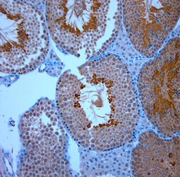 TRPM8 Antibody in Immunohistochemistry (Paraffin) (IHC (P))